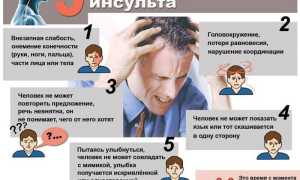 Как выявить первые признаки инсульта