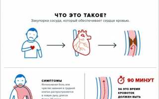 Что такое острый коронарный синдром