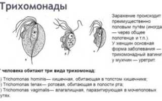 Что такое трихомониаз: строение, опасность, причины, симптомы, диагностика, лечение, профилактика