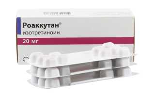 Роаккутан