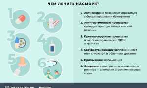 Лечение хронического ринита у взрослых