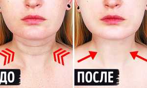 Как убрать морщины на шее