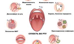 Сухость во рту — сухо как в пустыне