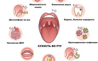 Сухость во рту — сухо как в пустыне