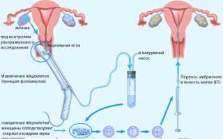 Cтимуляция овуляции при ЭКО