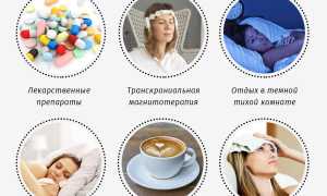 Лечение мигрени