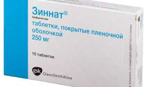 Зиннат