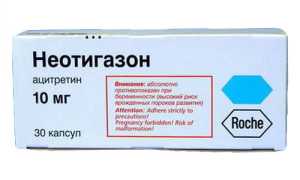 Неотигазон
