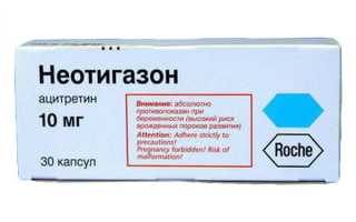 Неотигазон
