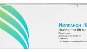 Импланон НКСТ