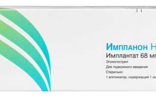 Импланон НКСТ