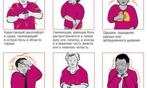 Как самостоятельно распознать инфаркт миокарда