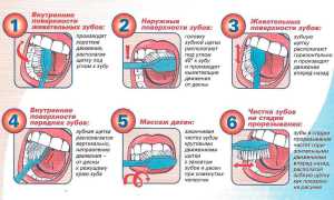Как чистить зубы электрической зубной щеткой