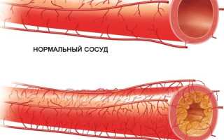 Что делать, если появились темные пятна в глазах