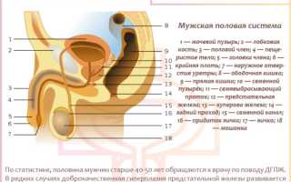 Гиперплазия предстательной железы – что это?