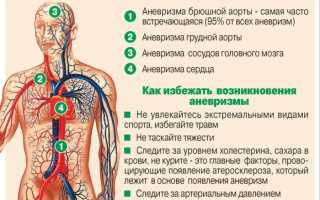 7 советов для снижения риска аневризмы