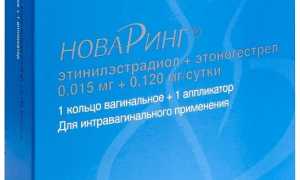 НоваРинг