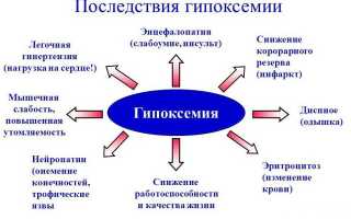 Гипоксемия: факторы риска и особенности лечения