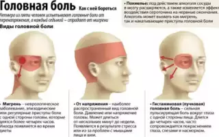 Мигрень — патология приступов головной боли