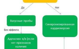 Первая помощь и диагностика при пароксизмальной тахикардии