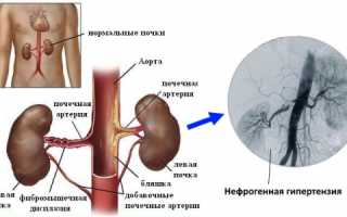 Аналоги препарата фозиноприл