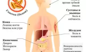 Непереносимость глютена