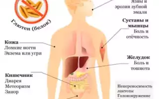 Непереносимость глютена